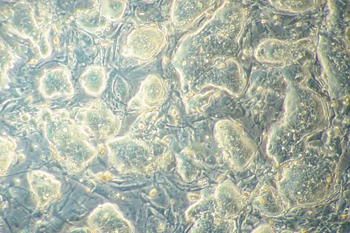 Image of mouse embryonic stem cells.